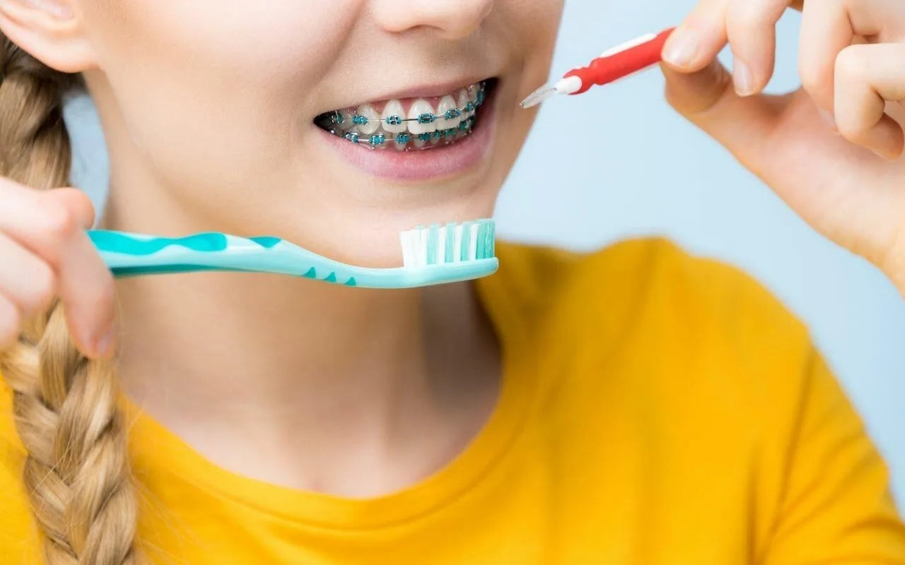 Do They Clean Your Teeth Before Braces and Does It Matter?